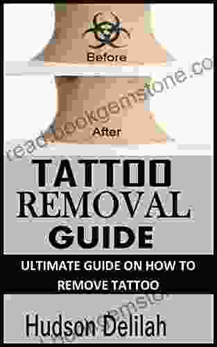 TATTOO REMOVAL GUIDE: ULTIMATE GUIDE ON HOW TO REMOVE TATTOO